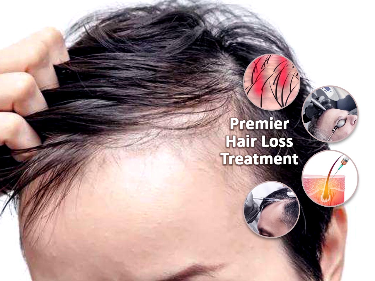 Premier Hair Loss Treatment