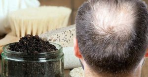 CAFFEINE SHAMPOO FOR HAIR LOSS