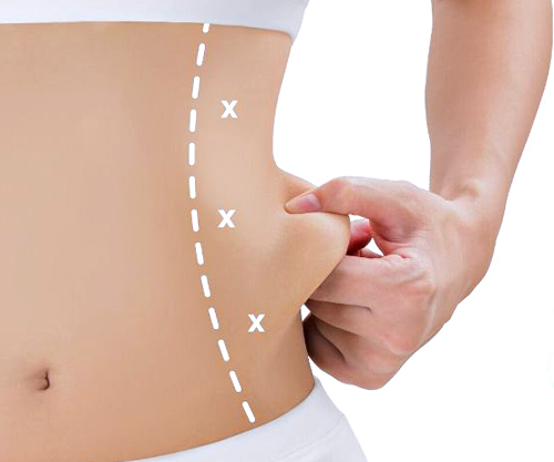 Clatuu Fat Freezing