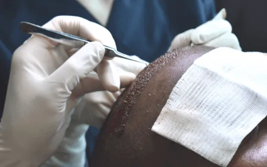 Minimal Invasive procedure