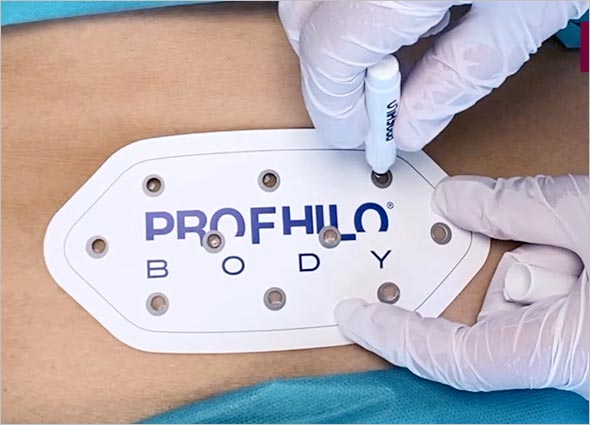 PROFHILO BODY