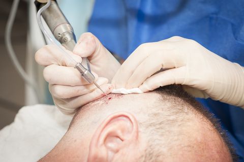 Less to No visible scarring and lesser discomfort
