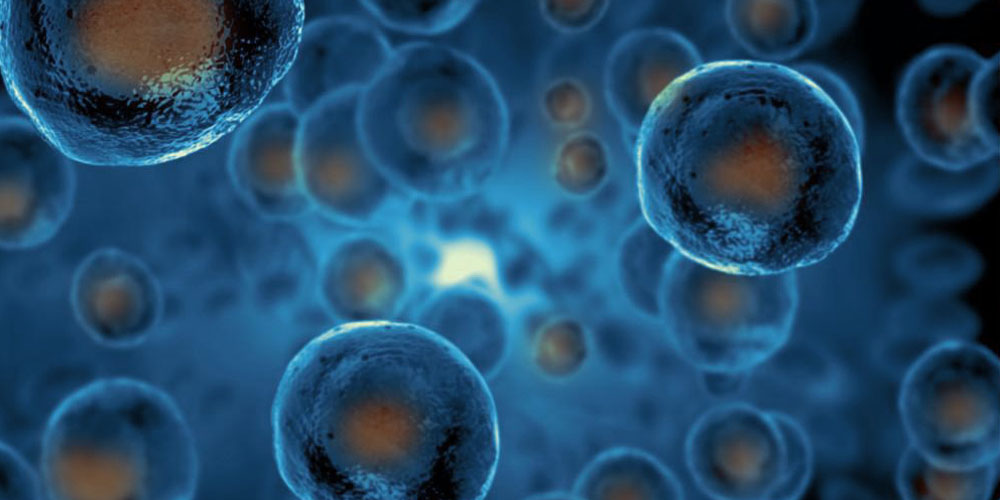 Exosome Therapy