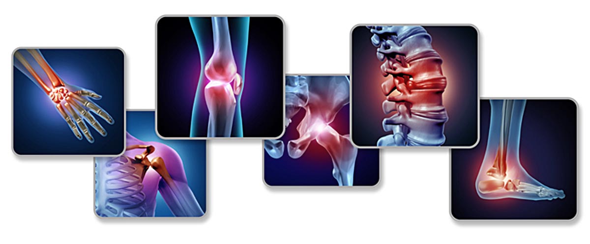 MESENCHYMAL CELL THERAPY