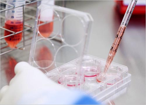 MESENCHYMAL CELL THERAPY 