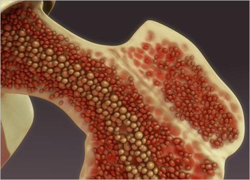 MESENCHYMAL CELL THERAPY 