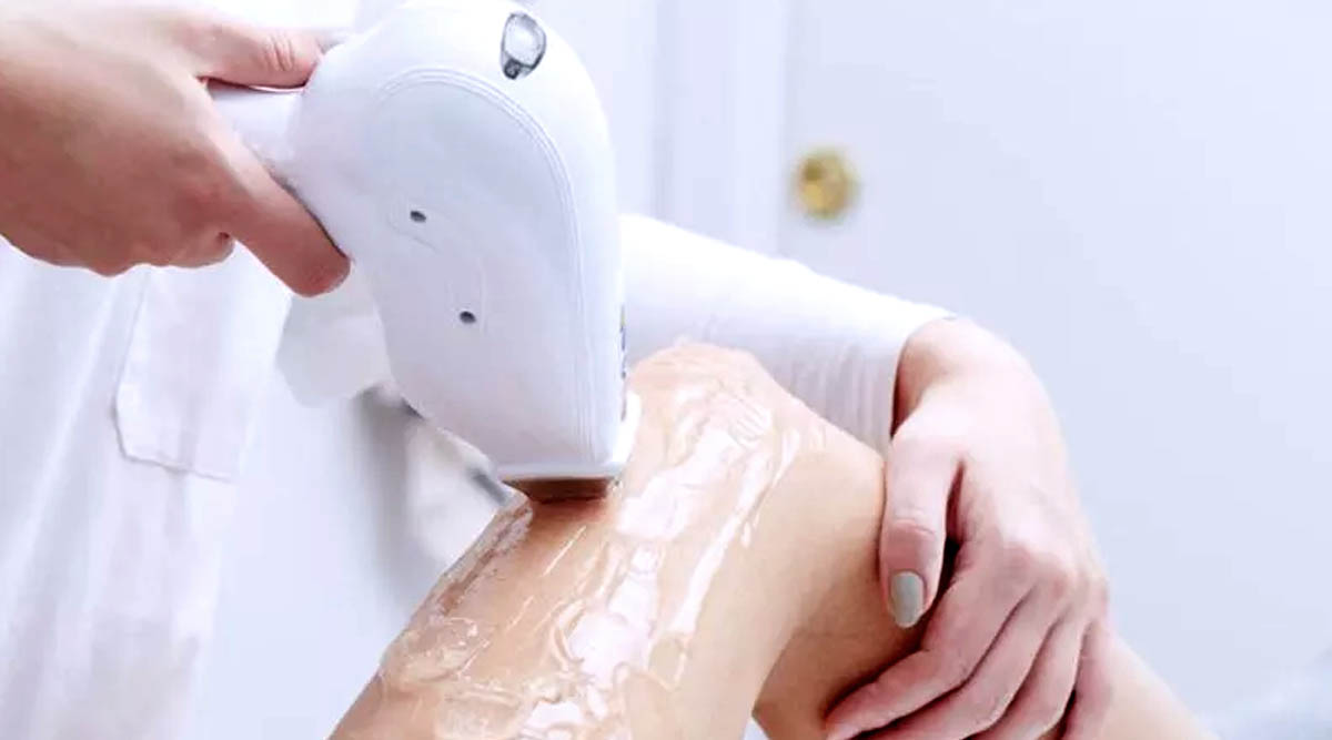 DIODE LASER FOR HAIR REMOVAL