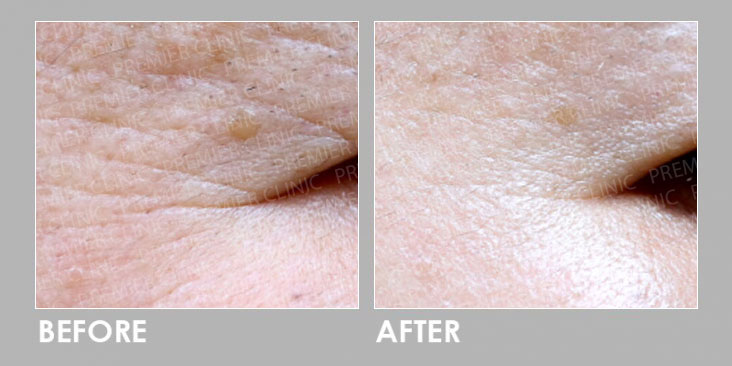 GOURI ANTI-AGING TREATMENT