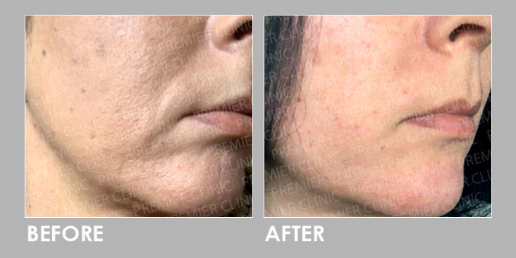 GOURI ANTI-AGING TREATMENT