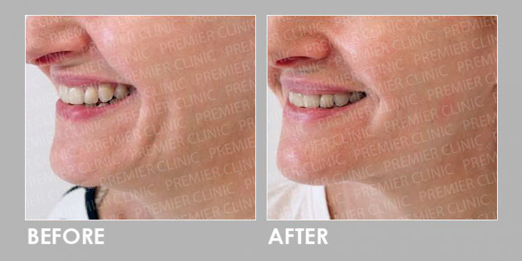 GOURI ANTI-AGING TREATMENT