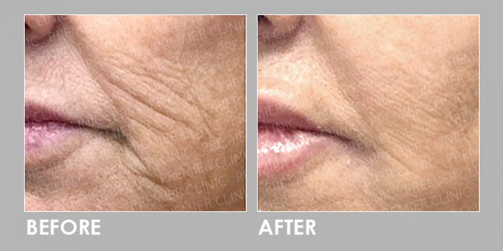 GOURI ANTI-AGING TREATMENT