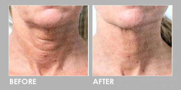 GOURI ANTI-AGING TREATMENT