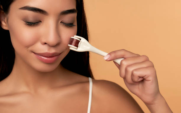Pros and Cons of Microneedling Treatment