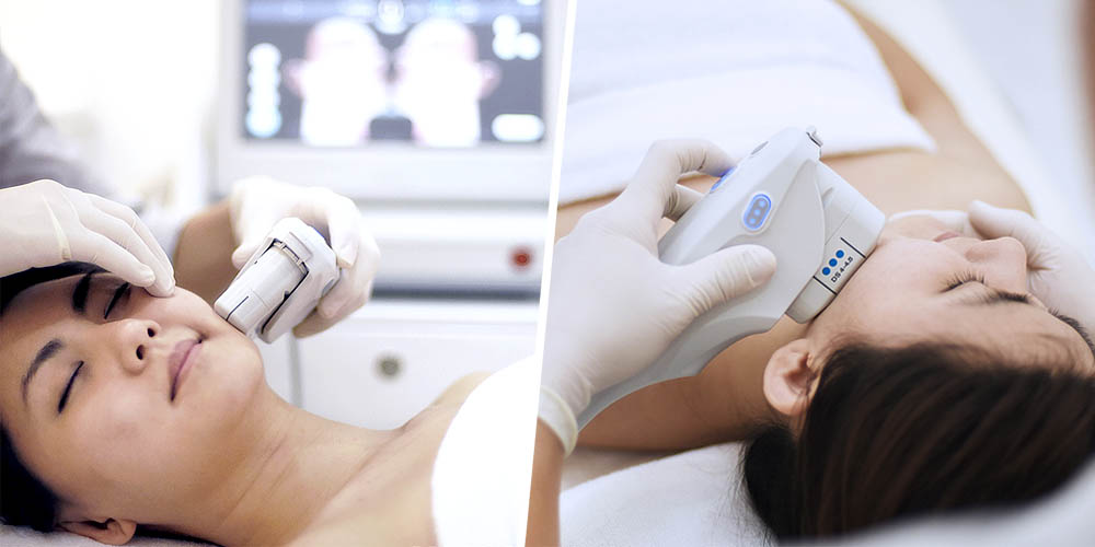 Ultherapy HIFU Treatment