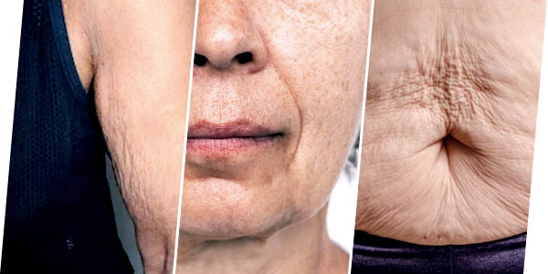 WHAT SKIN IMPERFECTIONS CAN BE SOLVED
