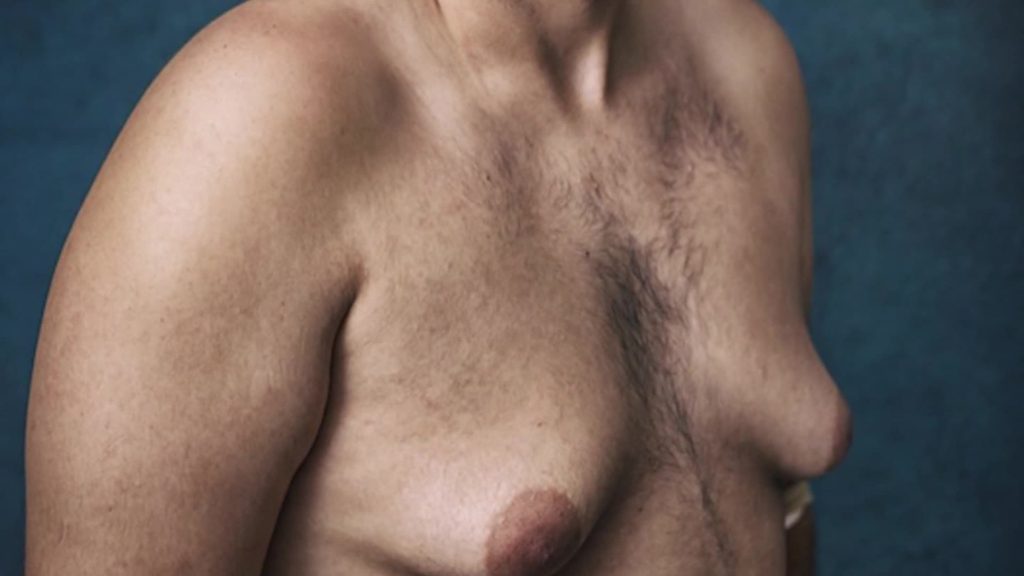 AGING MAN BOOB