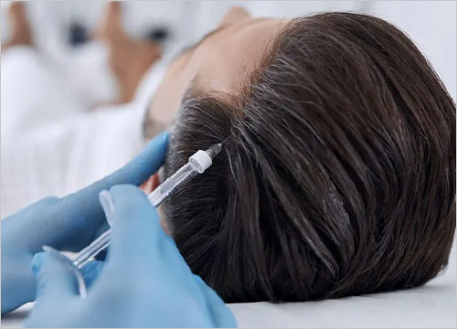Exosome Therapy