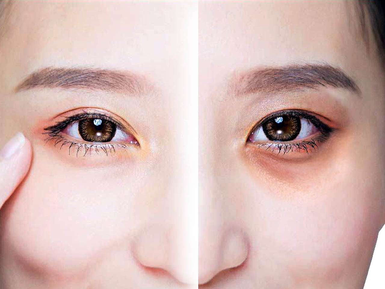 Eyes-Fillers Promo