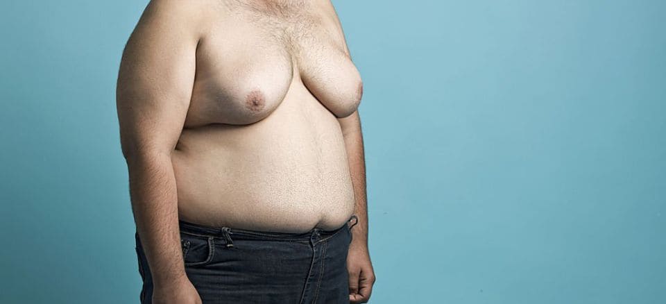 Hormonal imbalances