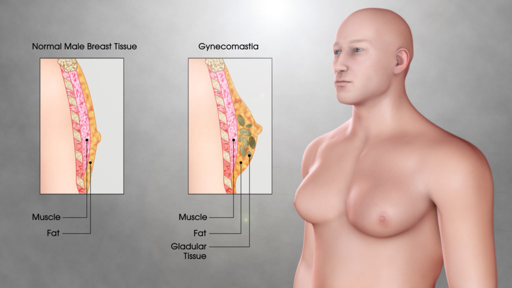 Hormonal imbalances