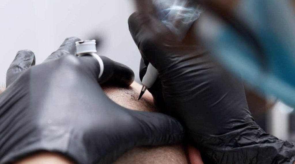 Hair Follicles Enhancer (Scalp Micropigmentation) 