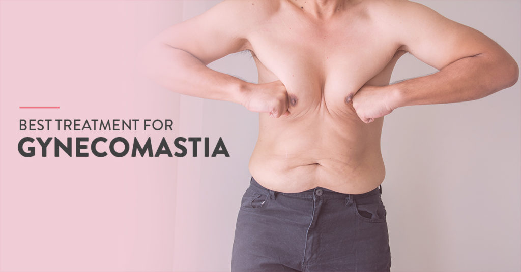 SYMPTOMS OF GYNECOMASTIA