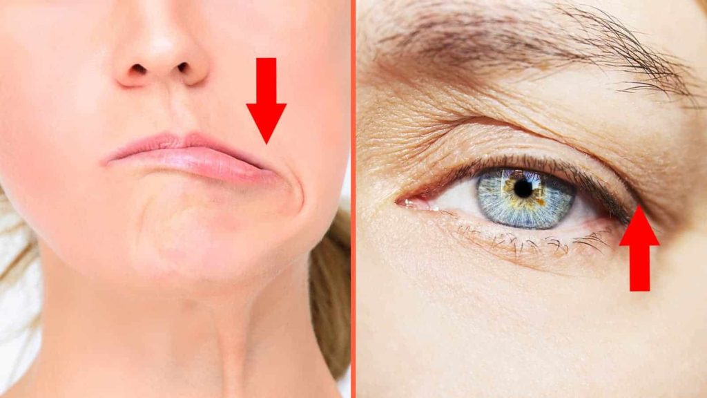 BOTOX IS UNSAFE