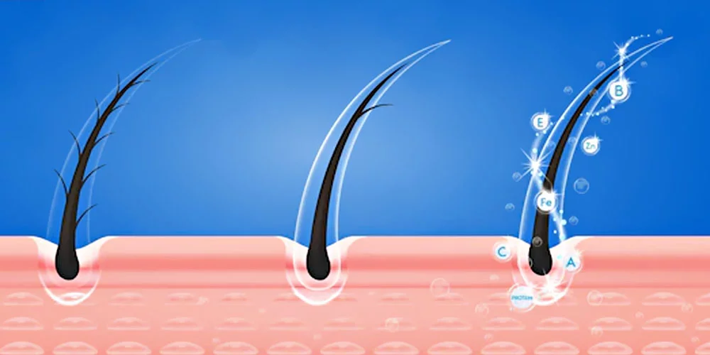 exosome injections