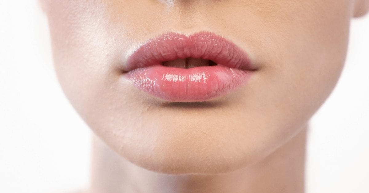 LIP FILLER : THE BATTLE BETWEEN EUROPE AND ASIA