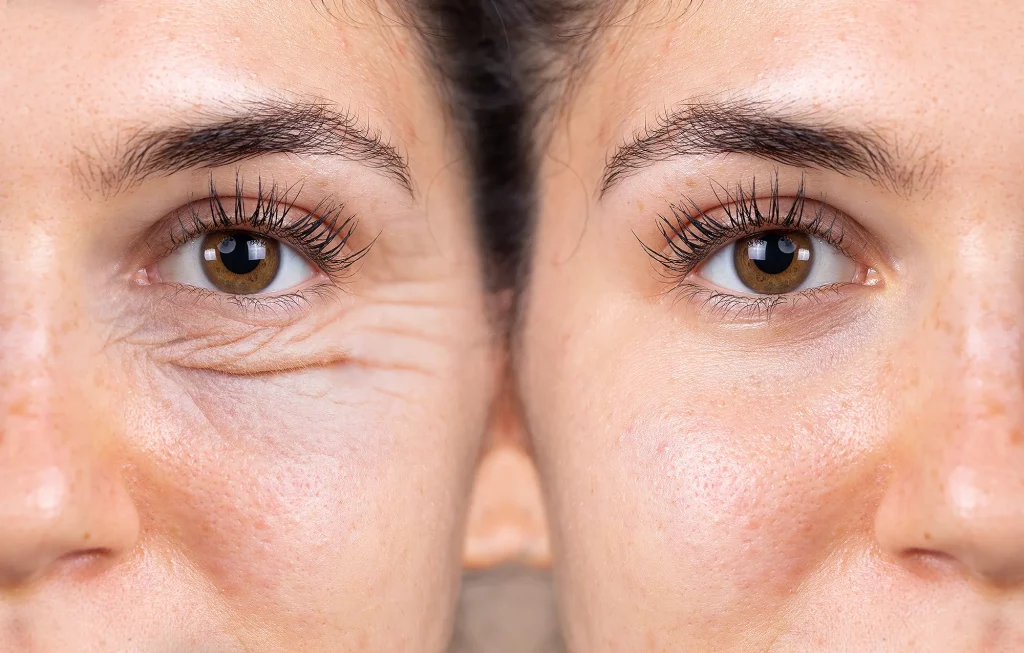 FIGHT WRINKLES