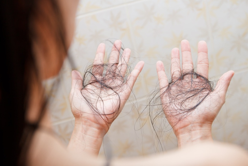 NUTRITIONAL DEFICIENCIES hair loss