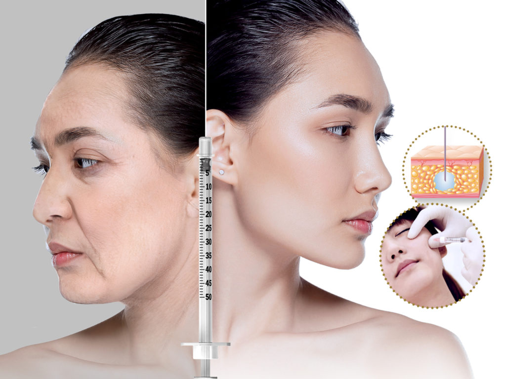Botox + Filler Promo