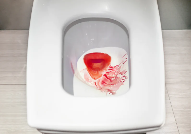 Postpartum Bleeding