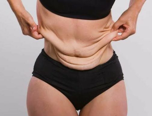Get rid of excess skin