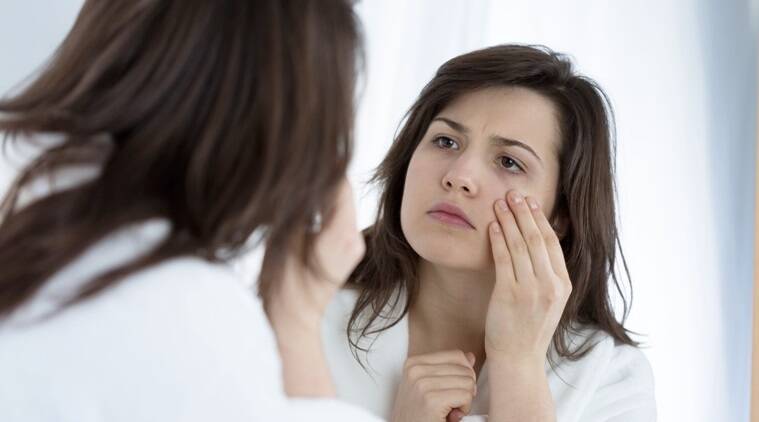 Genetic factors dark eyes circle